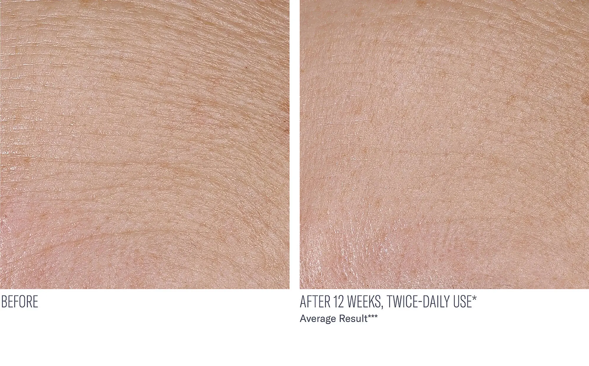 Before and after photos of a skincare protocol, Atelier Med selection.