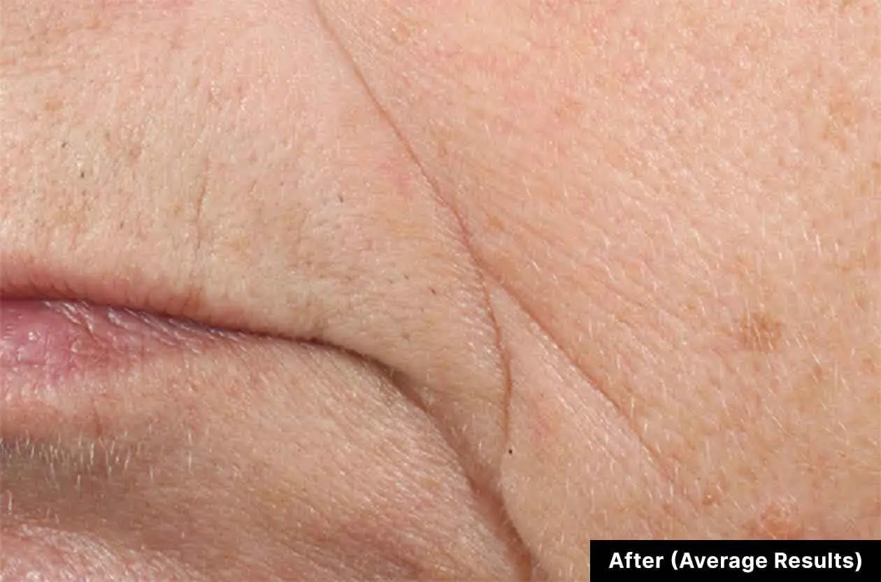 Before and after photos of a skincare protocol, Atelier Med selection.