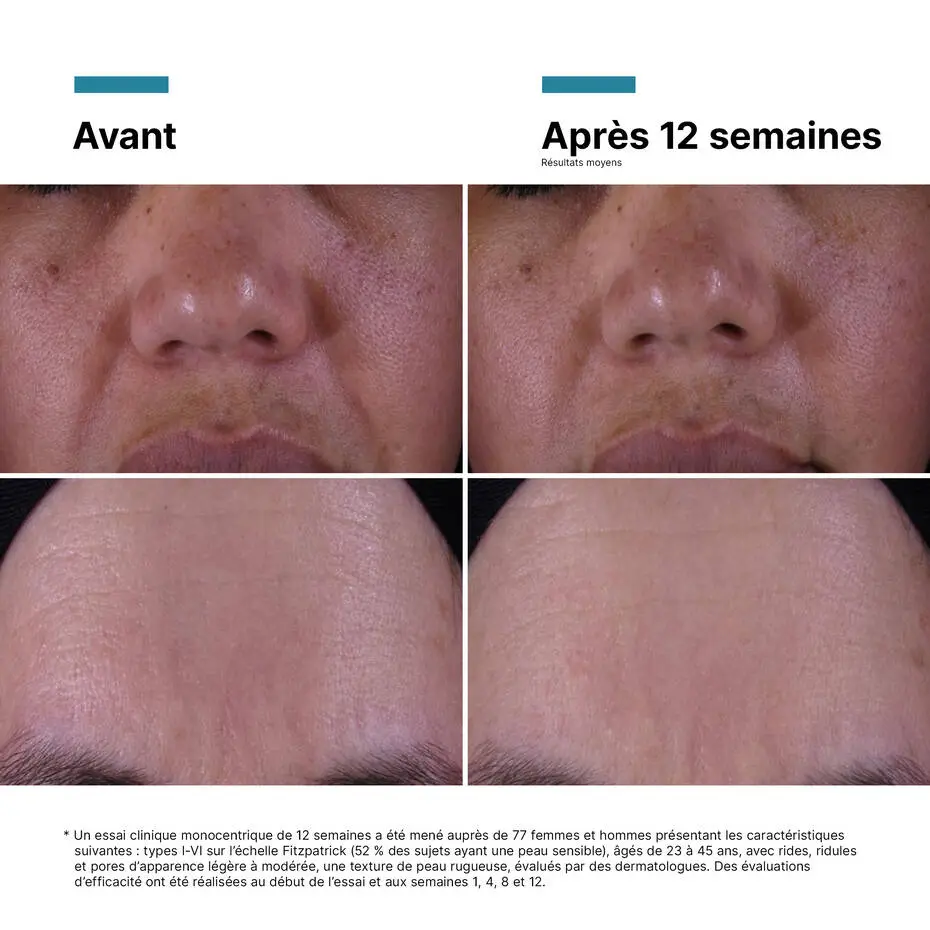 P-TIOX Crème, SKINCEUTICALS: cosmeceutical skincare, Atelier Med selection in Québec.