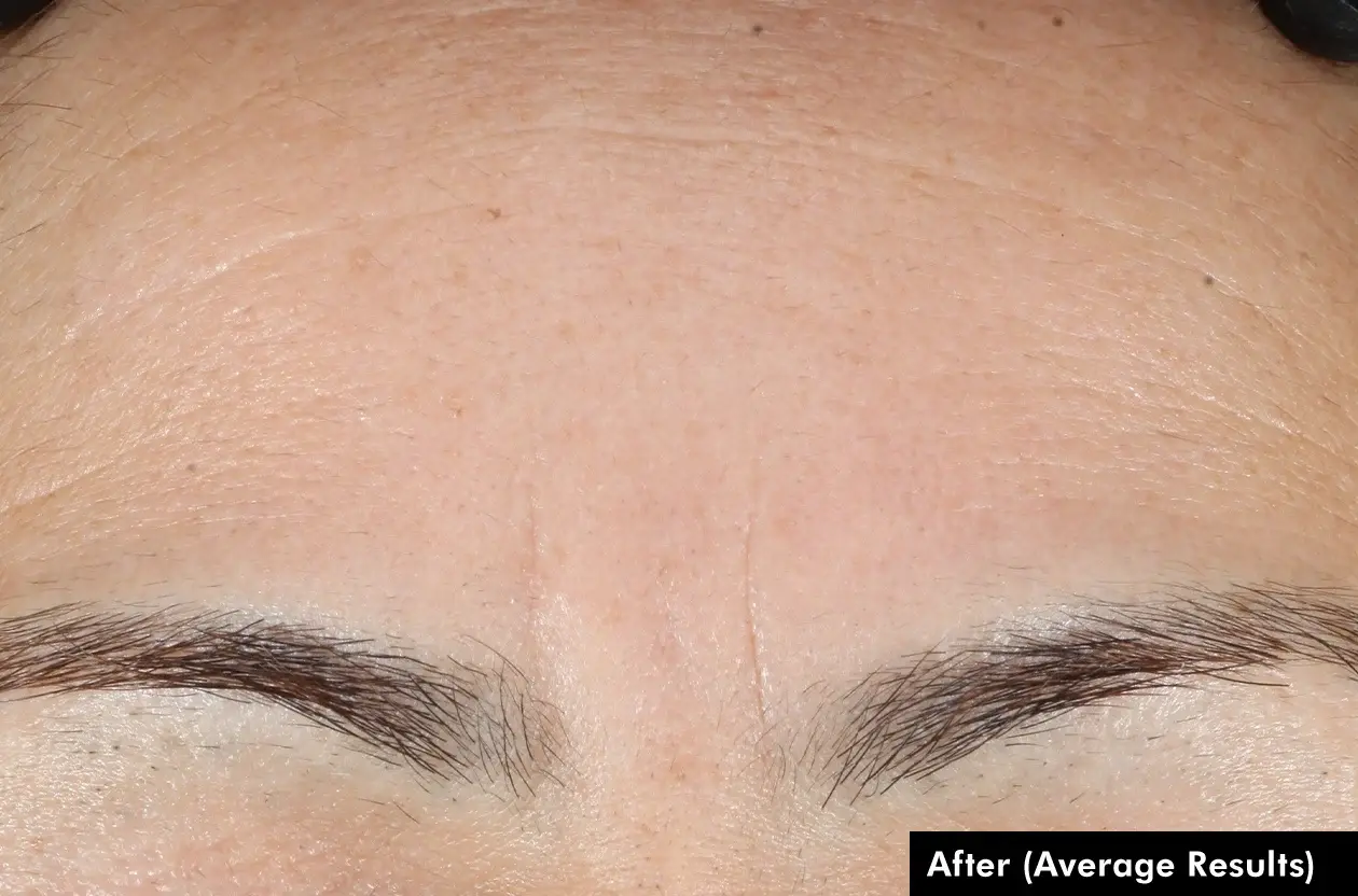Before and after photos of a skincare protocol, Atelier Med selection.